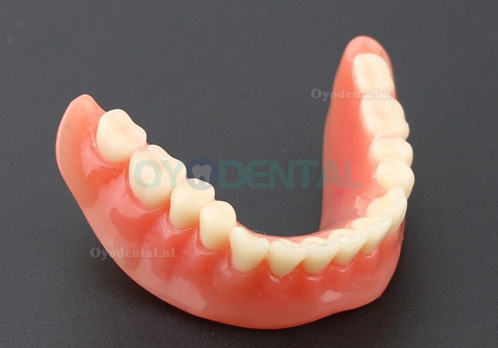 Tandentandenmodel Overdenture Inferieur met 2 implantaten Studiedemo Model 6002 01